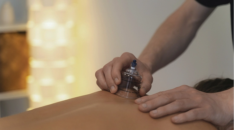 Cupping therapy on a person's back